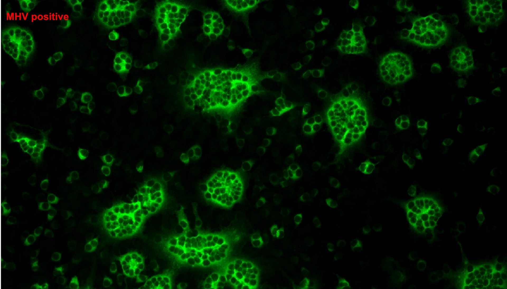 Microbiology Laboratory - a cell image captured with an immunofluorescence microscope