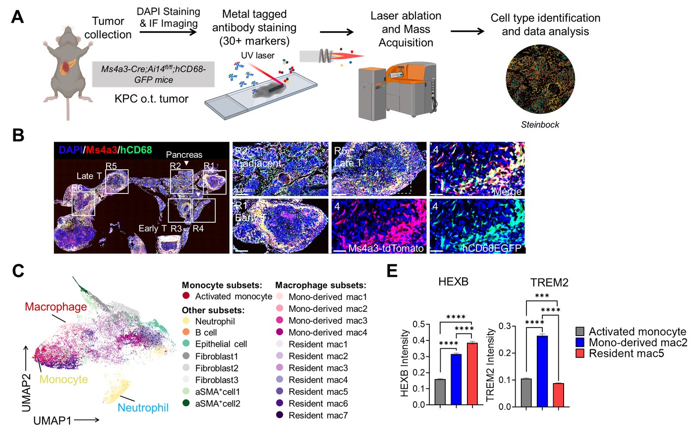 IMC analysis of Ms4a3-Cre mouse pancreatic tissue - multi-channel DAPI/Ms4a3/hCD68