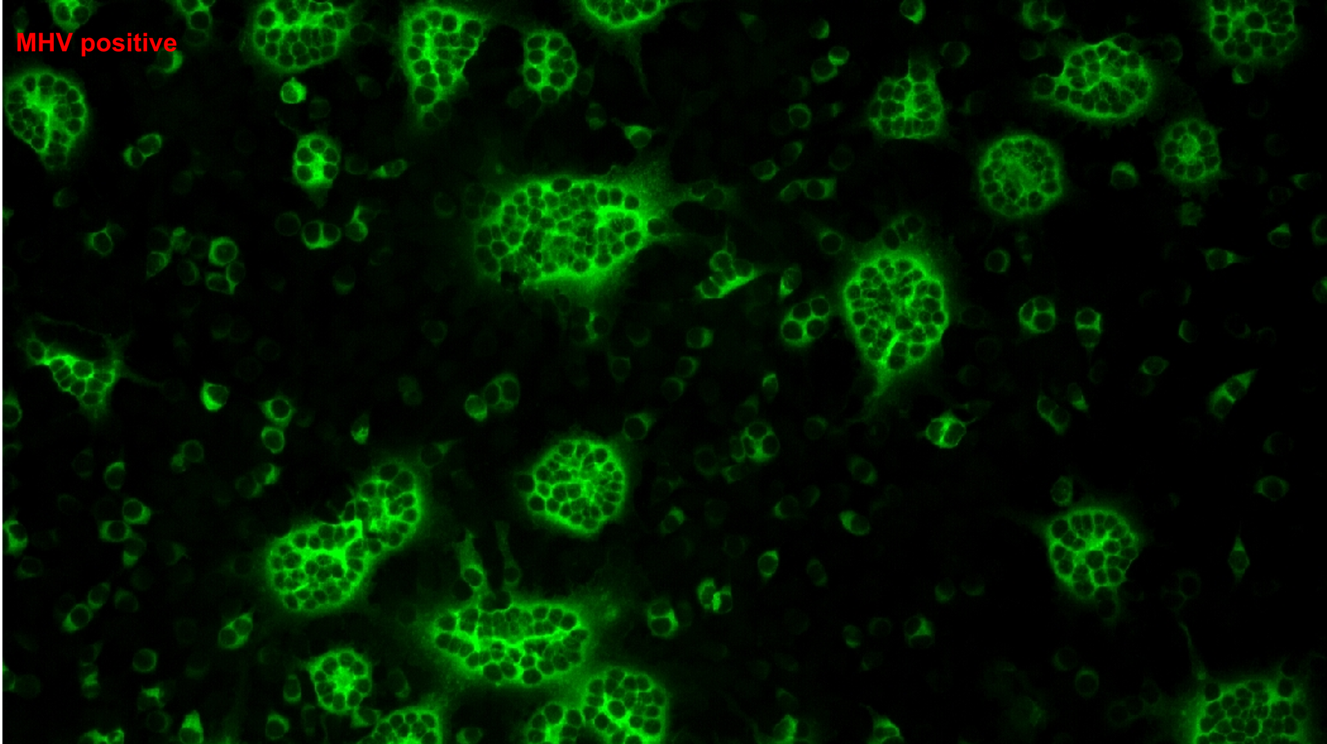 Fluorescence microscopy image positive for MHV