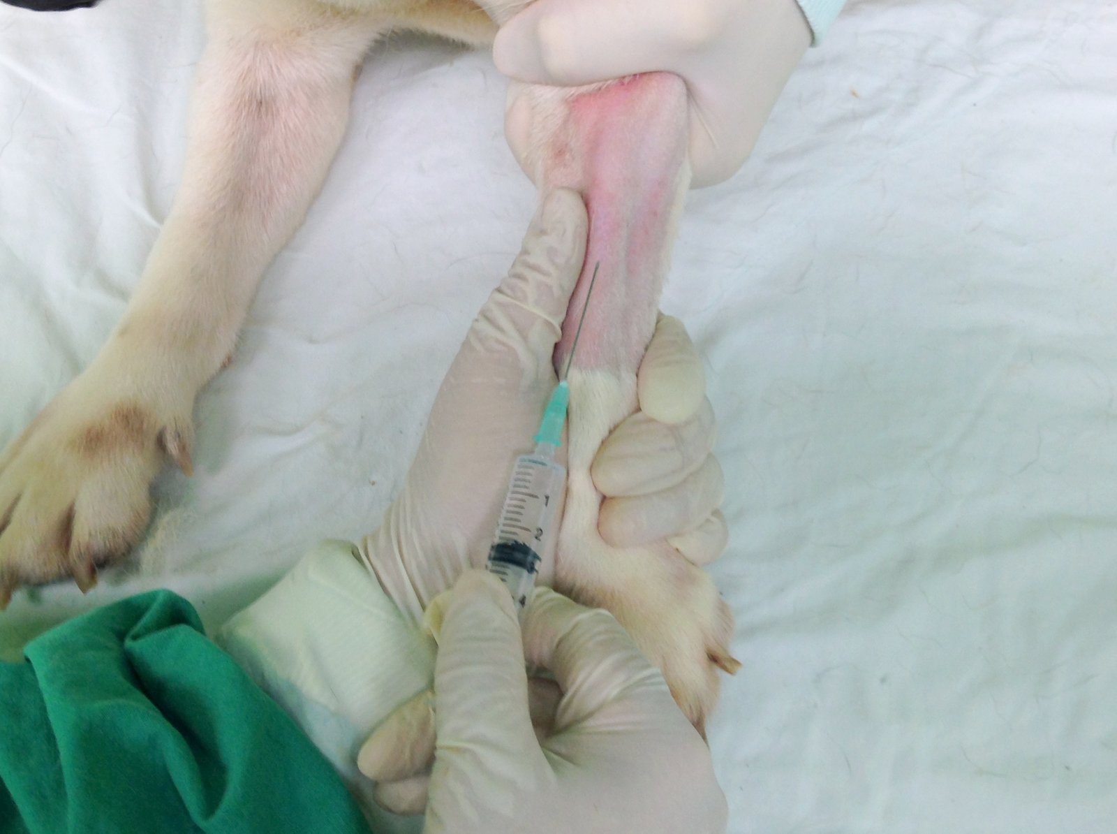 Cephalic vein (2)